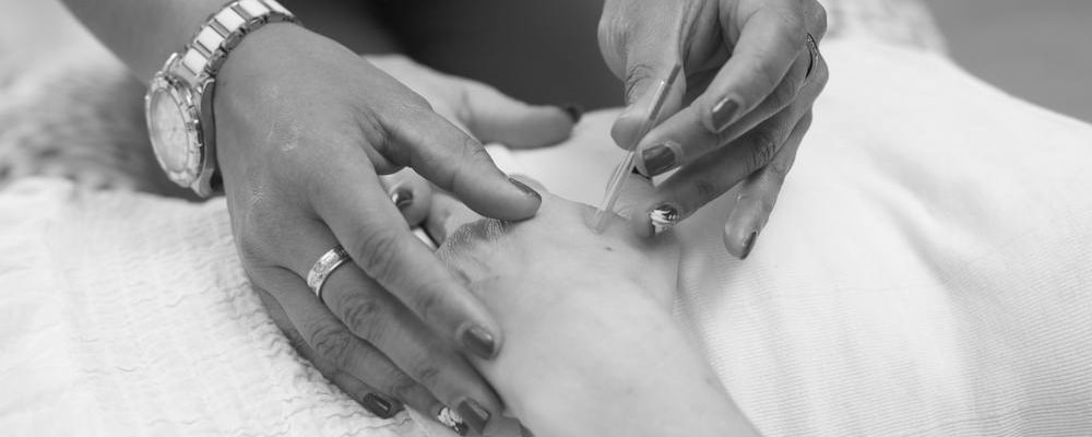 acupuncutre massage calgary endurahealth